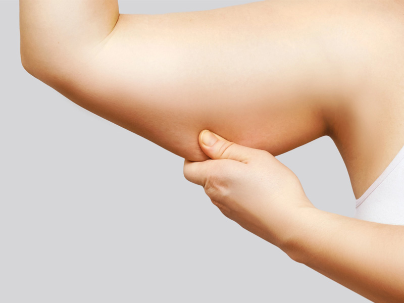 Arm Lift in Jacksonville at First Coast Plastic Surgery