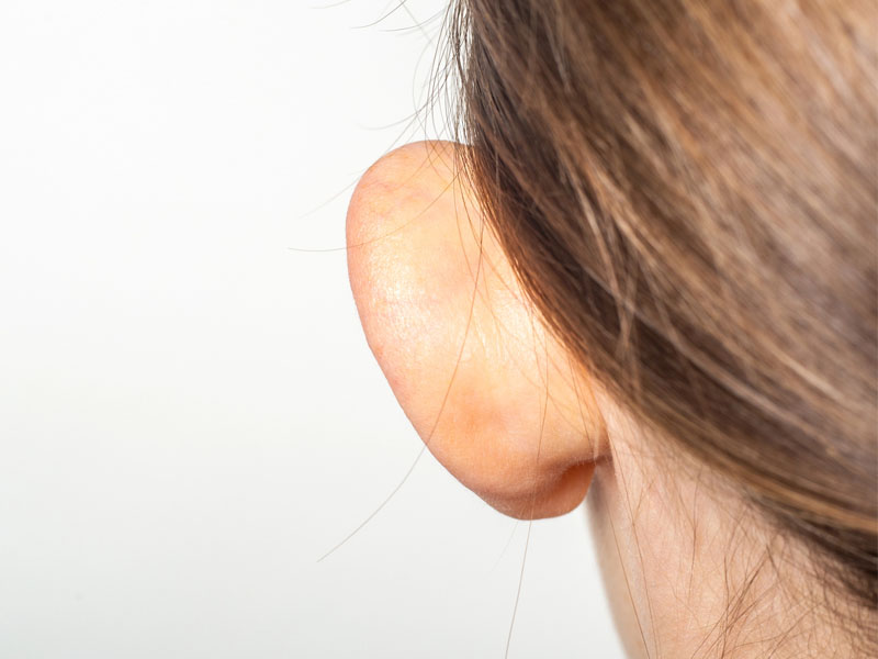 Arm Lift in Jacksonville at First Coast Plastic Surgery